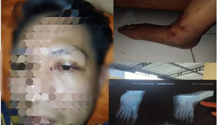 Penegakan Hukum di Polres Palopo Disorot, Diduga Korban Penganiayaan Ditetapkan Sebagai Tersangka